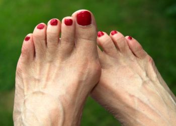 How My Bunions Saved Me: Overcoming Midlife Health Challenges And Finding New Purpose