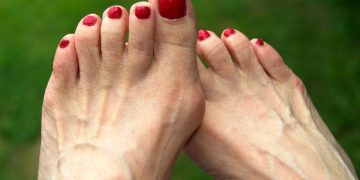 How My Bunions Saved Me: Overcoming Midlife Health Challenges And Finding New Purpose