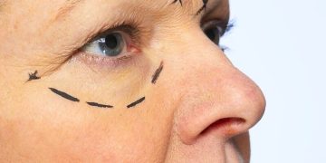 How Experts In Aesthetic Surgery Customize Procedures For Every Body Type