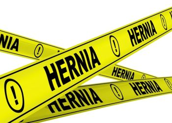 Why Hernia Mesh Lawsuits Are Increasing In 2025