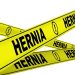 Why Hernia Mesh Lawsuits Are Increasing In 2025 Why Hernia Mesh Lawsuits Are Increasing In 2025
