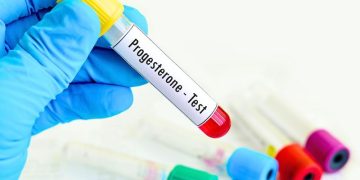 14 Surprising Benefits Of Progesterone After Menopause Every Woman Should Know