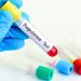 14 Surprising Benefits Of Progesterone After Menopause Every Woman Should Know 14 Surprising Benefits Of Progesterone After Menopause Every Woman Should Know