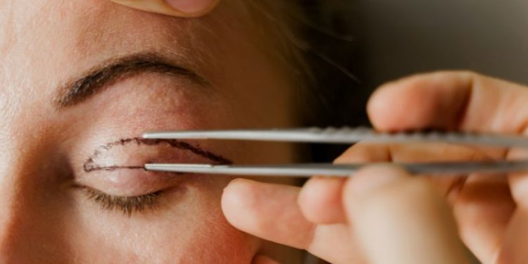 Facial Plastic Surgery For Women Over 50: Top California Surgeons, Treatments, And Advice Facial Plastic Surgery For Women Over 50: Top California Surgeons, Treatments, And Advice